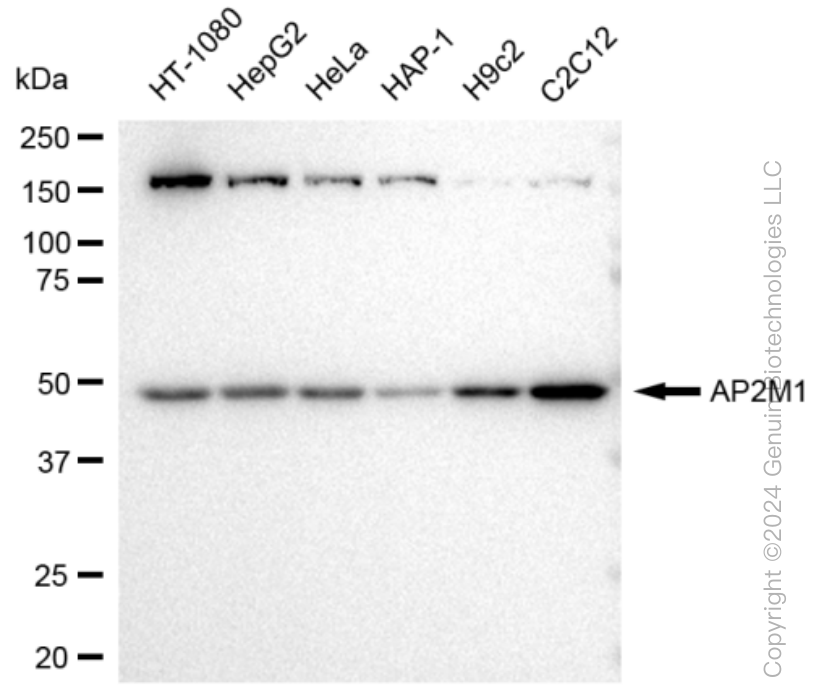 KD-Validated Anti-AP2M1 Rabbit Monoclonal Antibody ABG1317
