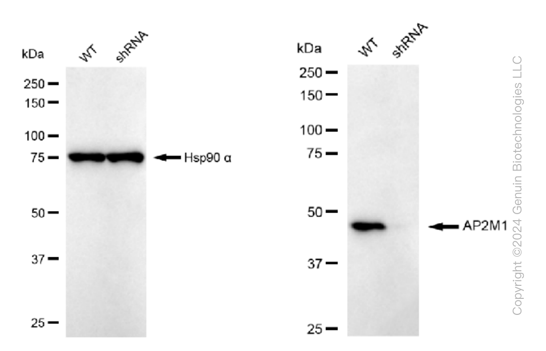 KD-Validated Anti-AP2M1 Rabbit Monoclonal Antibody ABG1317