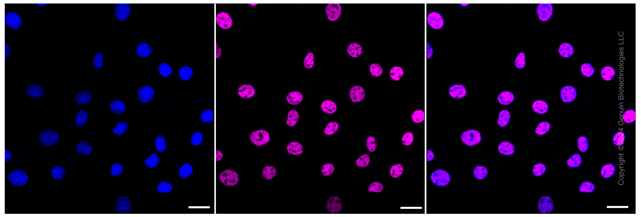 KD-Validated Anti-ARID1A Rabbit Monoclonal Antibody ABG1318