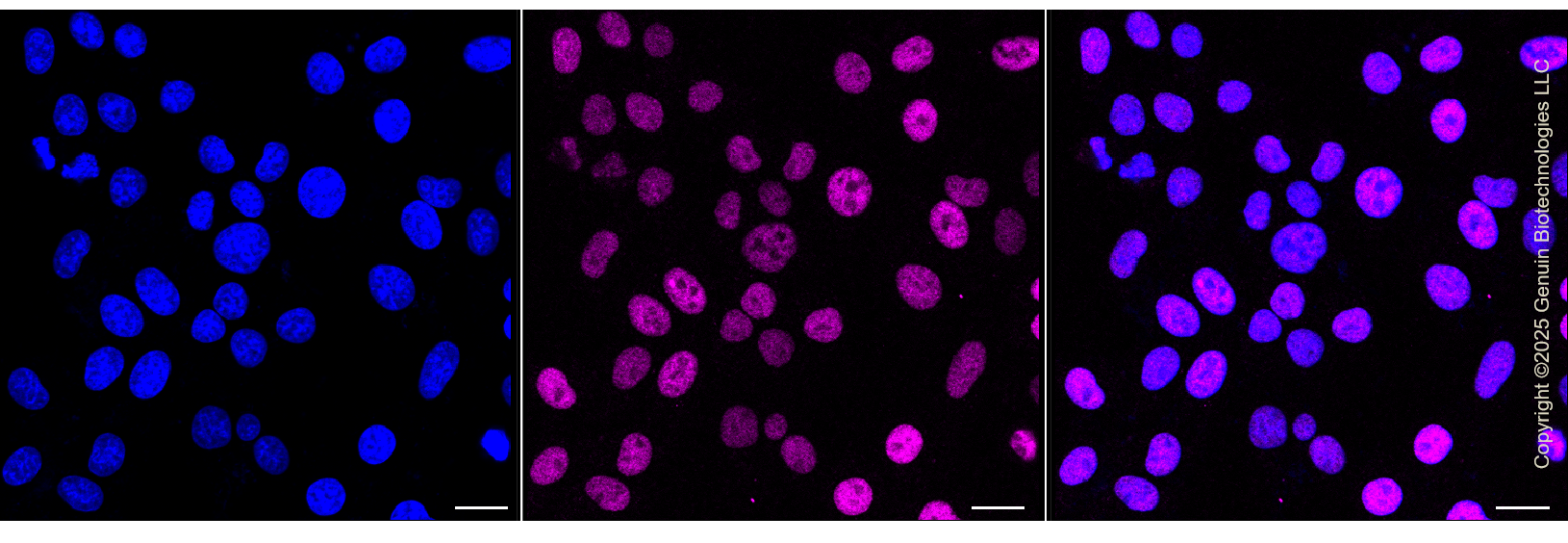 KD-Validated Anti-NEDD4L Rabbit Monoclonal Antibody ABG1319