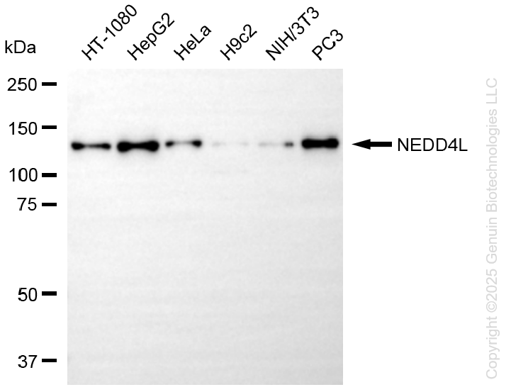 KD-Validated Anti-NEDD4L Rabbit Monoclonal Antibody ABG1319