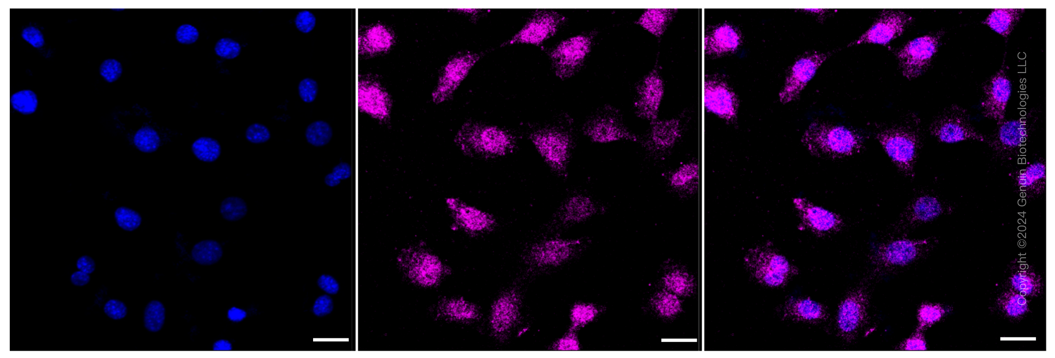 KD-Validated Anti-ATG4B Rabbit Monoclonal Antibody ABG1322