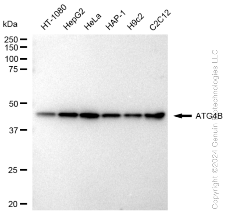 KD-Validated Anti-ATG4B Rabbit Monoclonal Antibody ABG1322