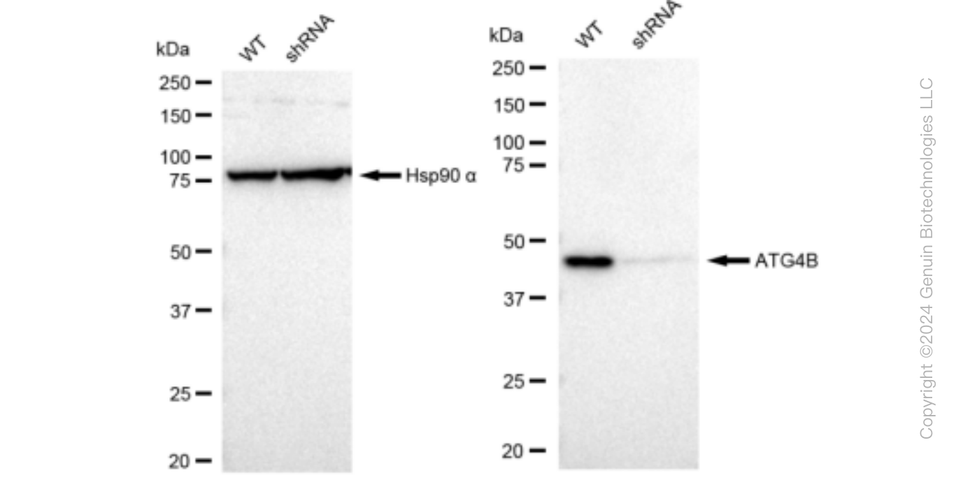 KD-Validated Anti-ATG4B Rabbit Monoclonal Antibody ABG1322