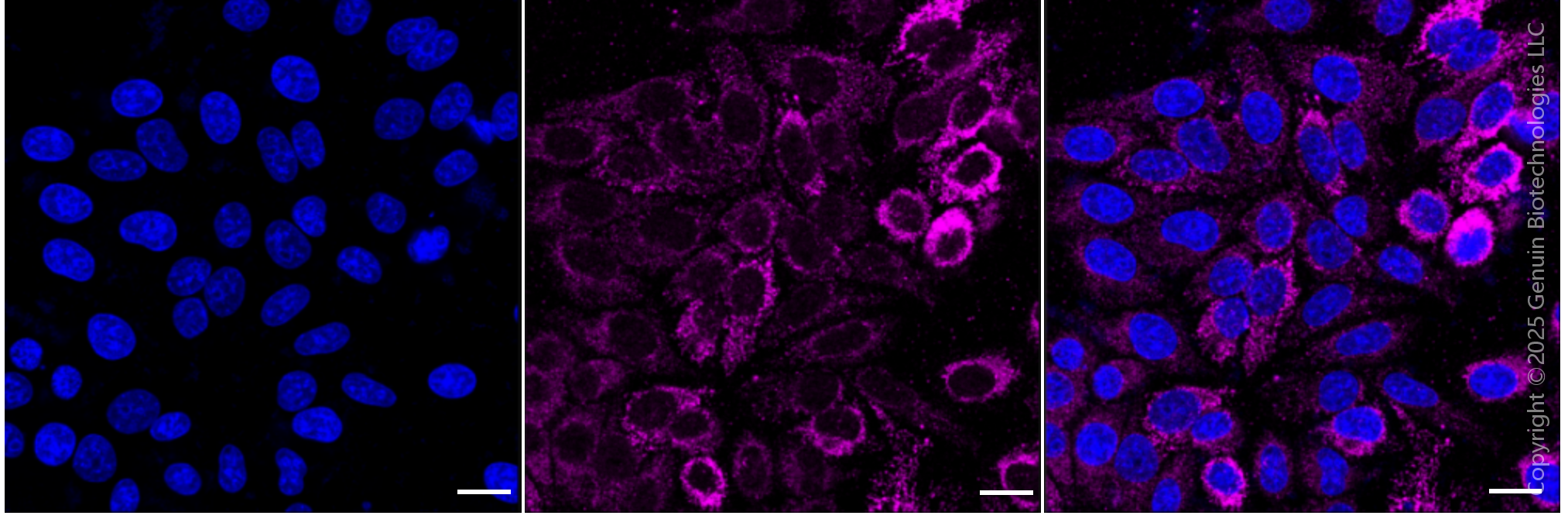 KD-Validated Anti-ATP5B Rabbit Monoclonal Antibody ABG1323