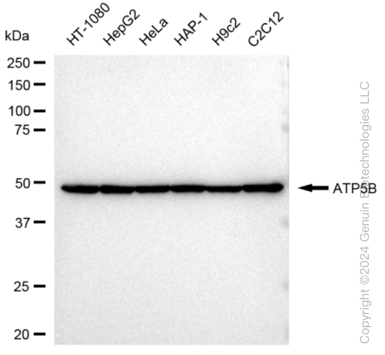 KD-Validated Anti-ATP5B Rabbit Monoclonal Antibody ABG1323