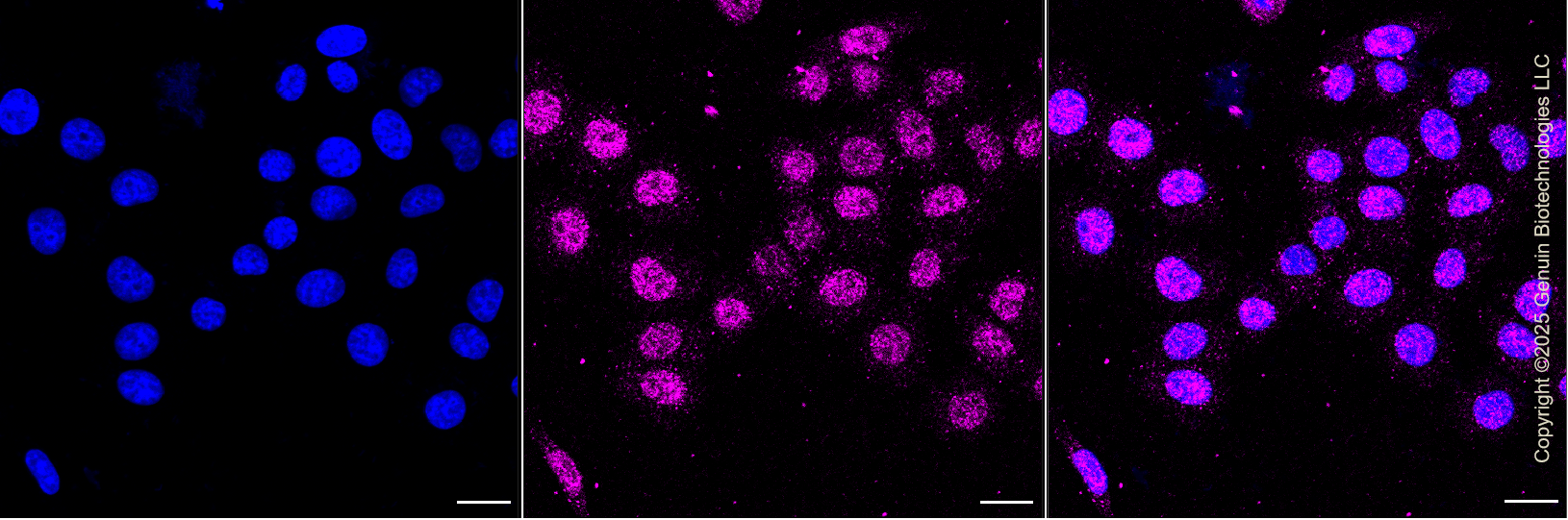 KD-Validated Anti-Forkhead Box O3 Rabbit Monoclonal Antibody ABG1325