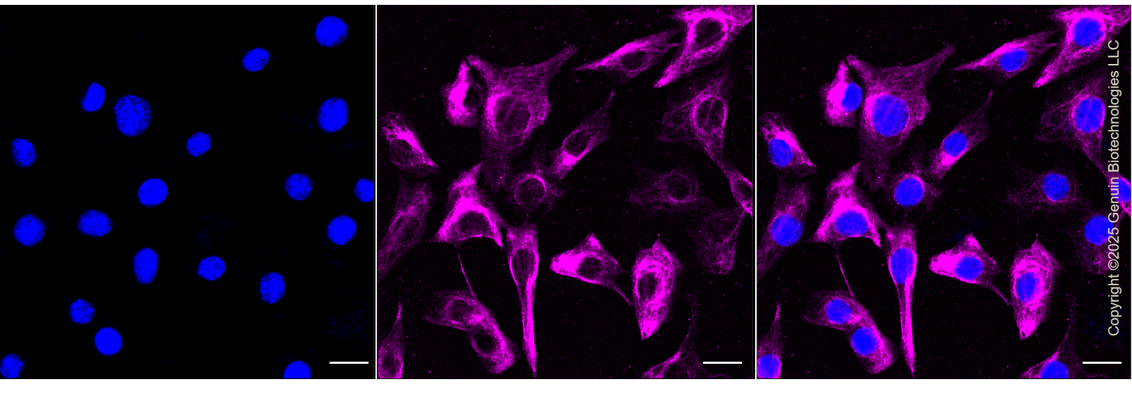 KD-Validated Anti-Fibroblast Growth Factor Receptor 3 Rabbit Monoclonal Antibody ABG1329