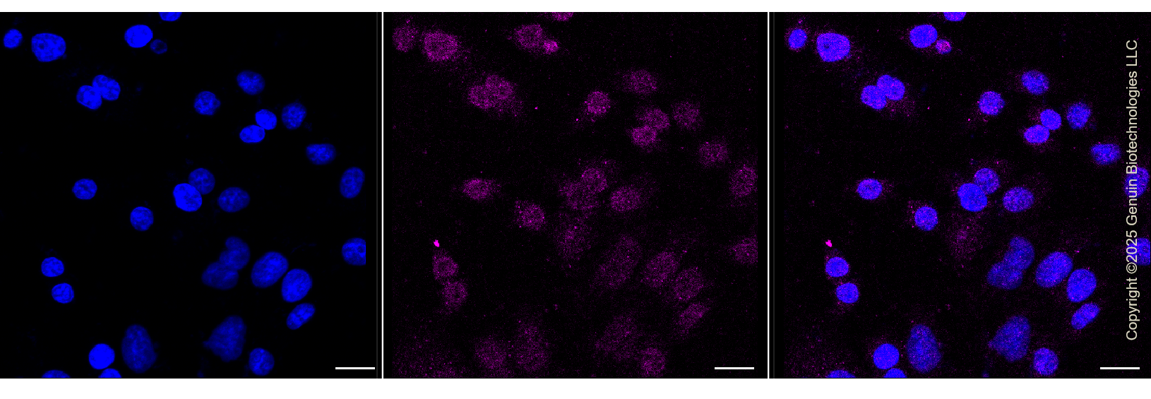 KD-Validated Anti-Activin A Receptor Like Type 1 Rabbit Monoclonal Antibody ABG1331