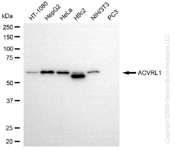 KD-Validated Anti-Activin A Receptor Like Type 1 Rabbit Monoclonal Antibody ABG1331