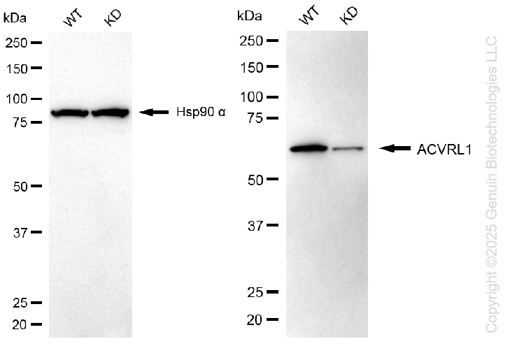 KD-Validated Anti-Activin A Receptor Like Type 1 Rabbit Monoclonal Antibody ABG1331