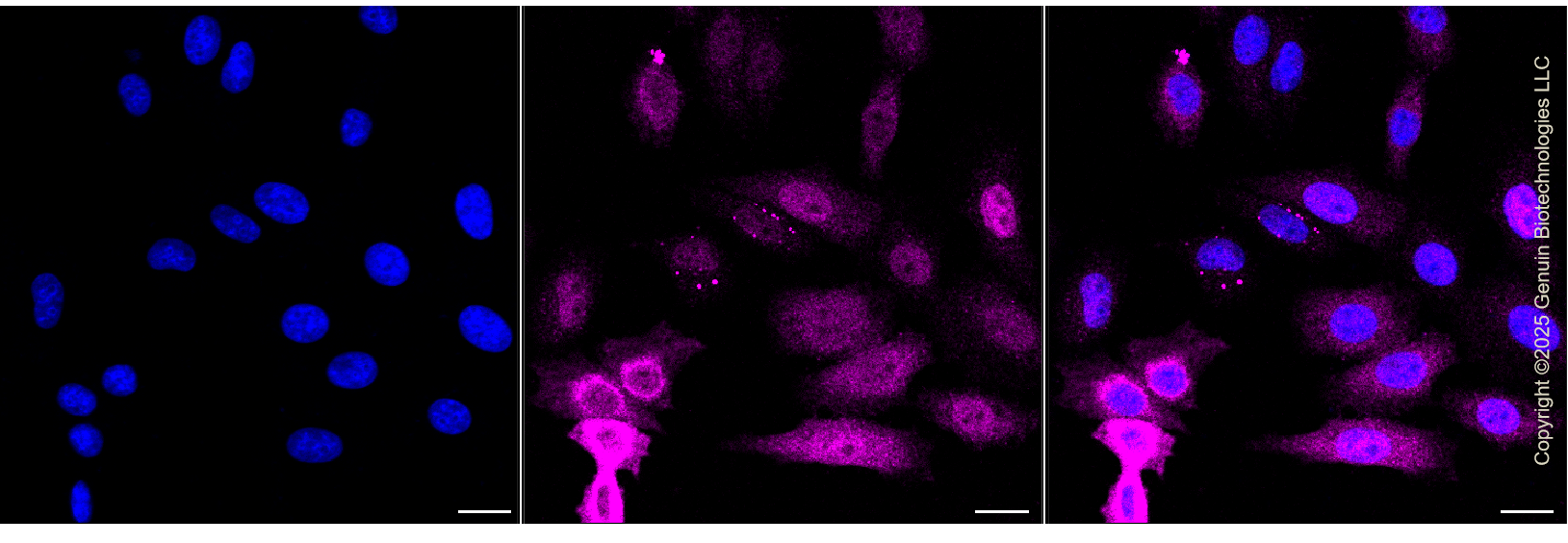KD-Validated Anti-Nuclear Factor Kappa B Subunit 2 Rabbit Monoclonal Antibody ABG1336