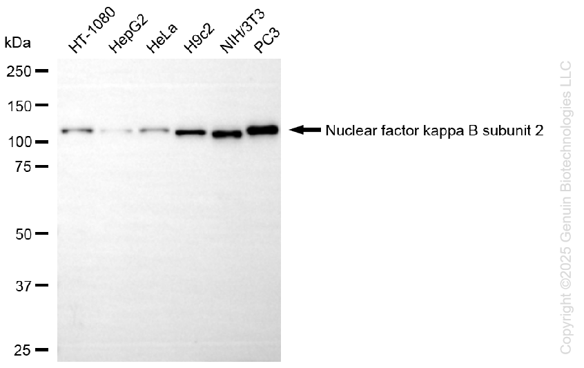 KD-Validated Anti-Nuclear Factor Kappa B Subunit 2 Rabbit Monoclonal Antibody ABG1336