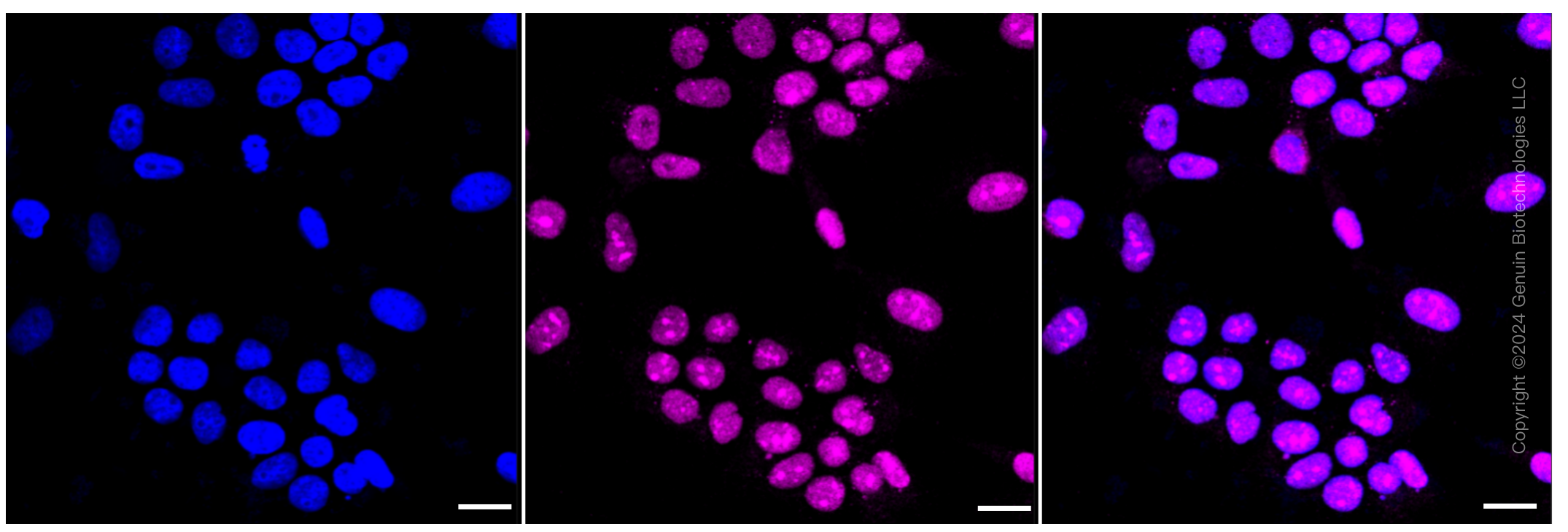 KD-Validated Anti-DEK Rabbit Monoclonal Antibody ABG1338