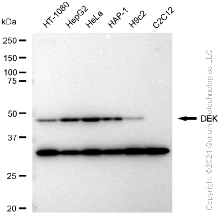 KD-Validated Anti-DEK Rabbit Monoclonal Antibody ABG1338