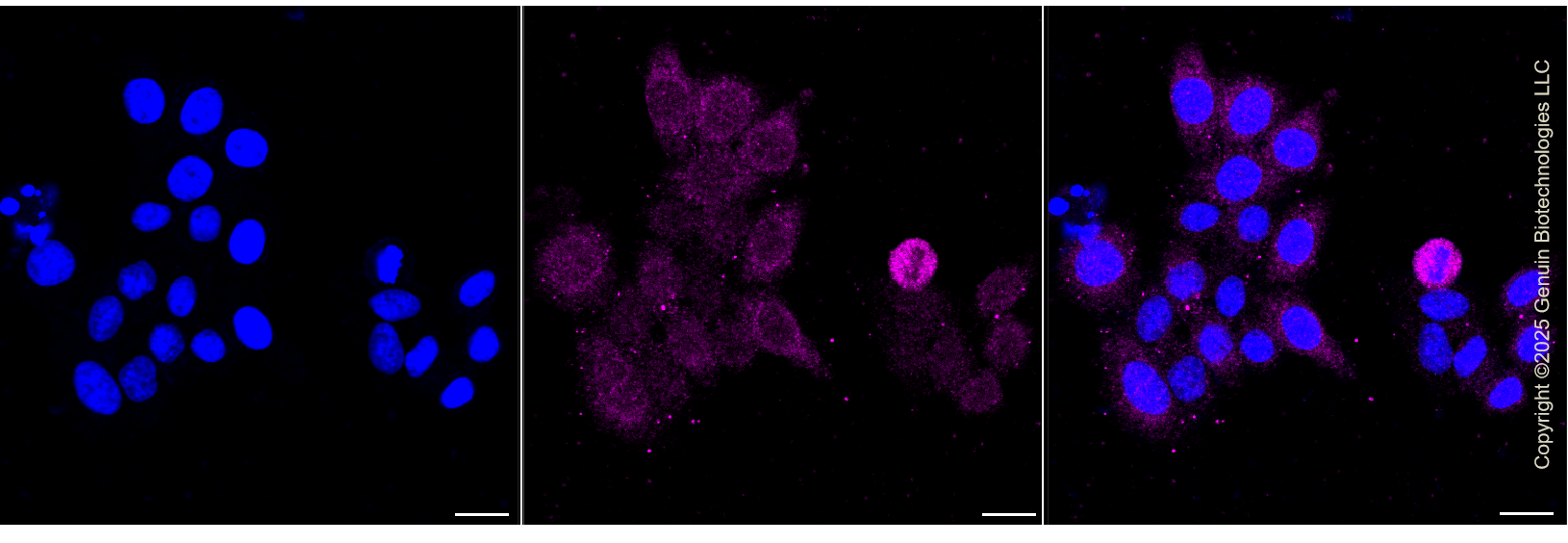 KD-Validated Anti-MELK Rabbit Monoclonal Antibody ABG1341