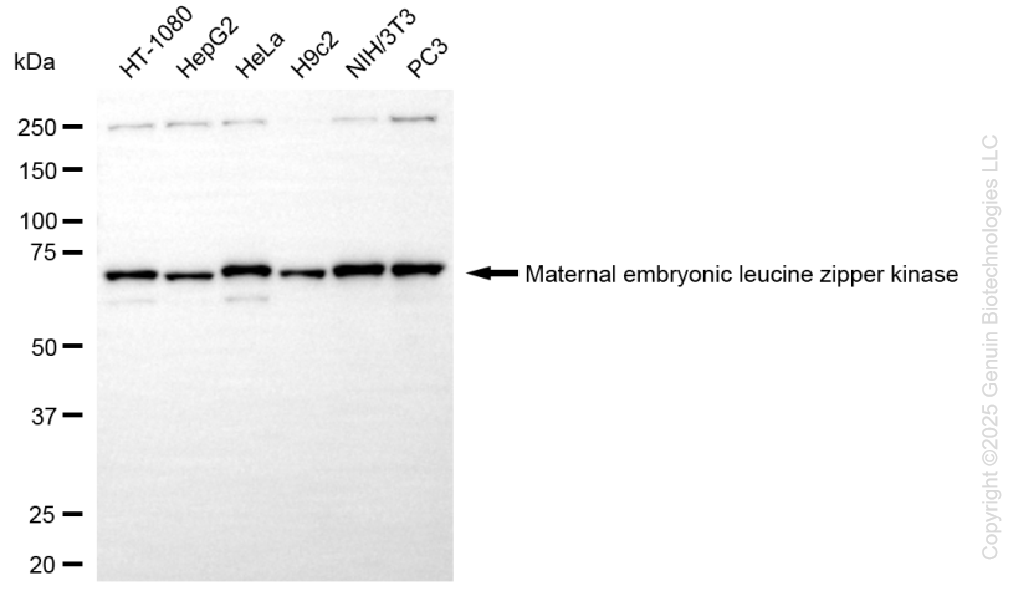 KD-Validated Anti-MELK Rabbit Monoclonal Antibody ABG1341