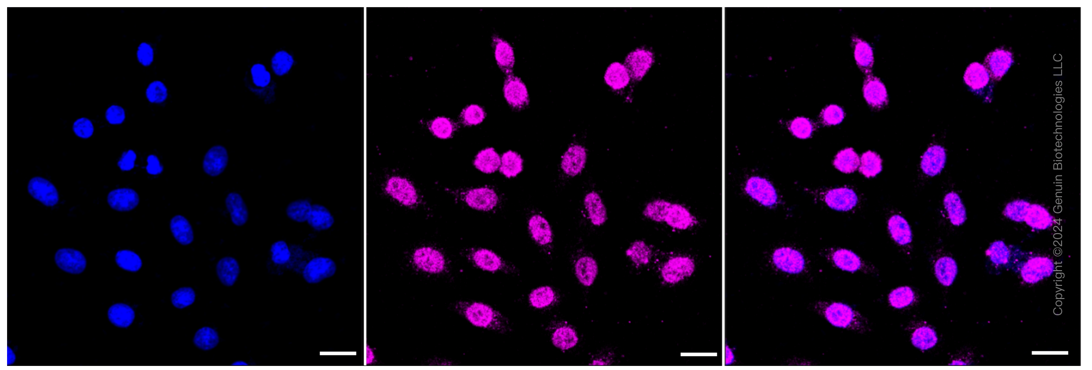 KD-Validated Anti-AP1G1 Rabbit Monoclonal Antibody ABG1342
