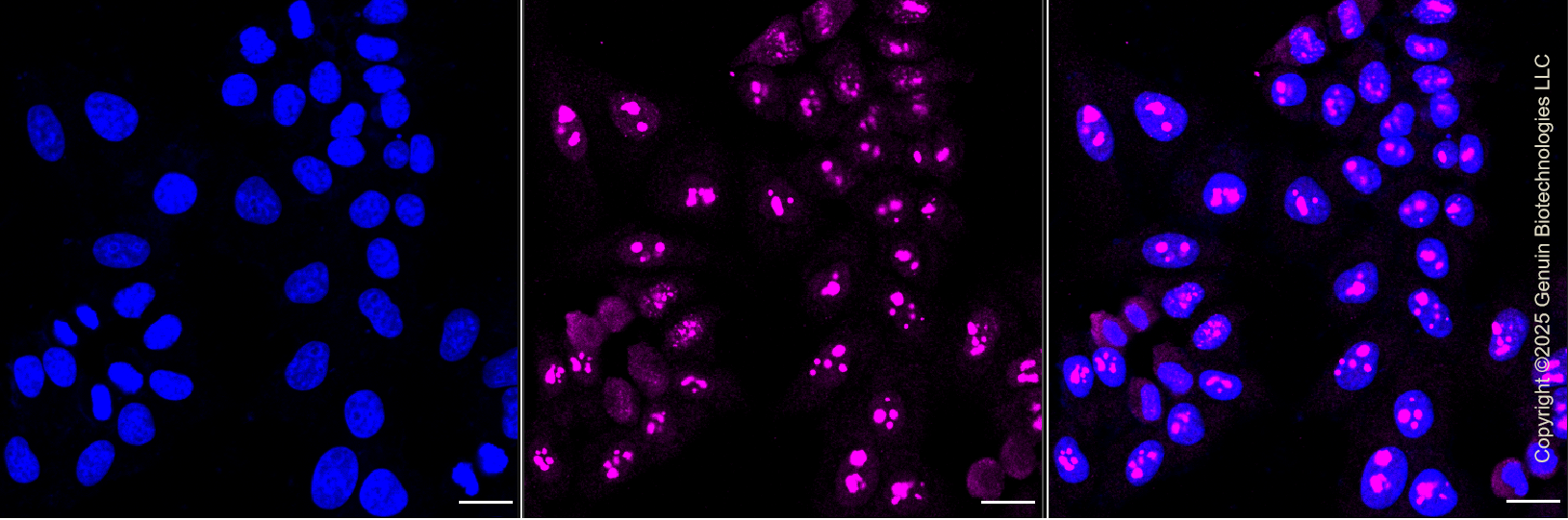 KD-Validated Anti-CGRP Receptor Component Rabbit Monoclonal Antibody ABG1345