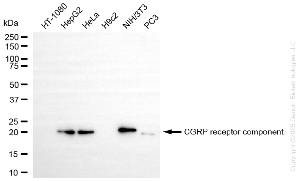 KD-Validated Anti-CGRP Receptor Component Rabbit Monoclonal Antibody ABG1345