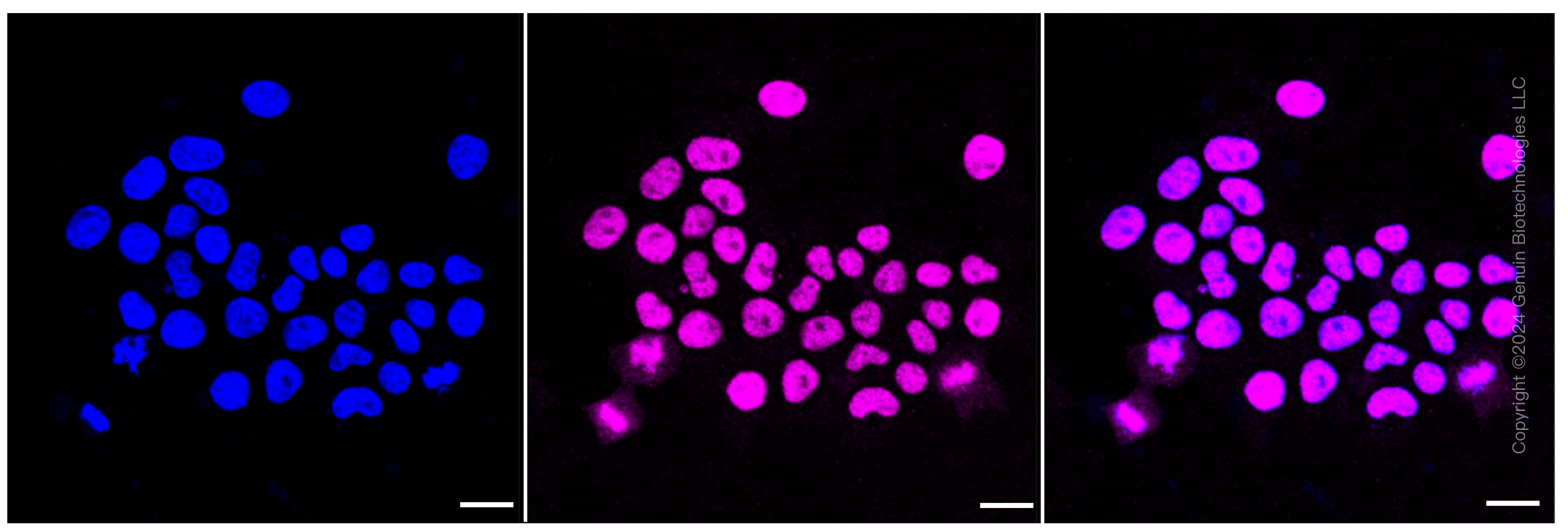 KD-Validated Anti-BAZ1B Rabbit Monoclonal Antibody ABG1346