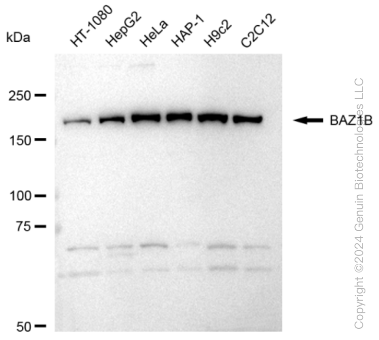 KD-Validated Anti-BAZ1B Rabbit Monoclonal Antibody ABG1346