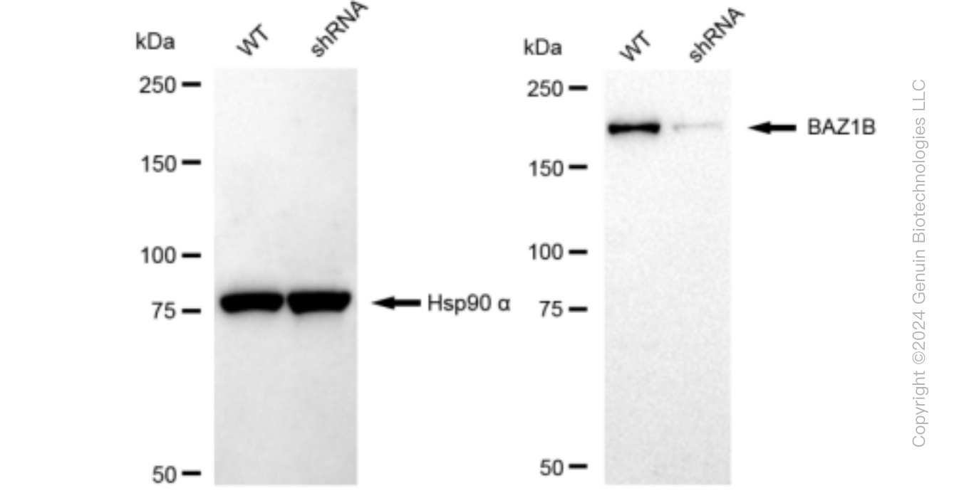 KD-Validated Anti-BAZ1B Rabbit Monoclonal Antibody ABG1346
