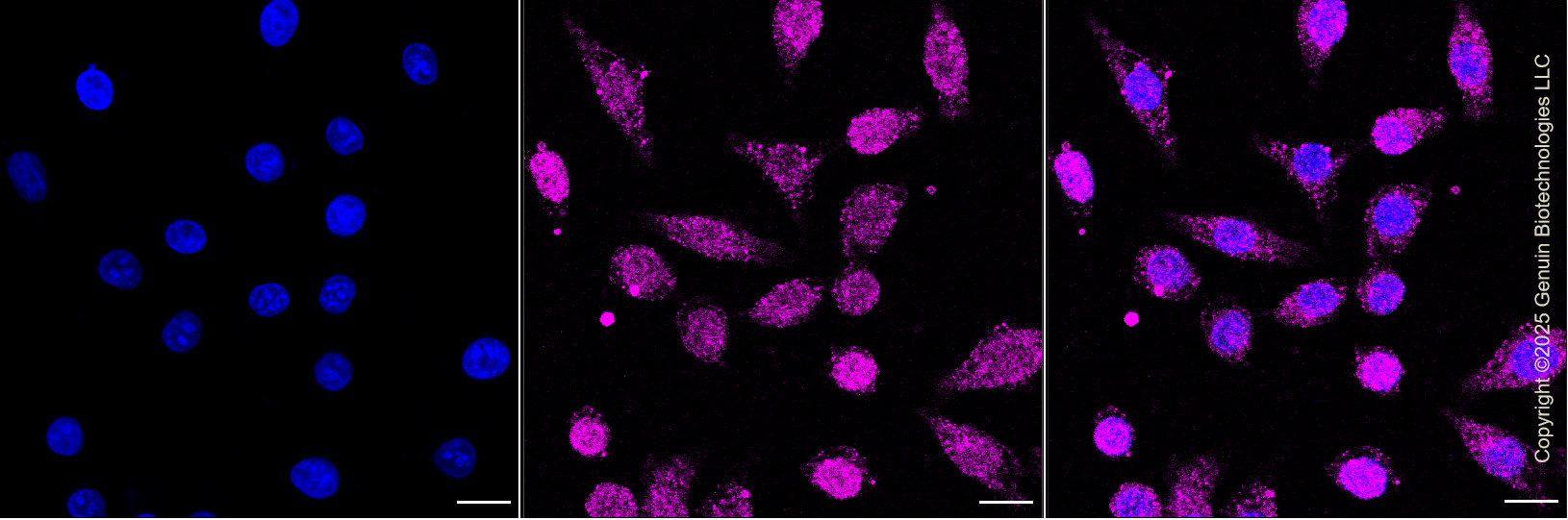 KD-Validated Anti-Exocyst Complex Component 2 Rabbit Monoclonal Antibody ABG1348