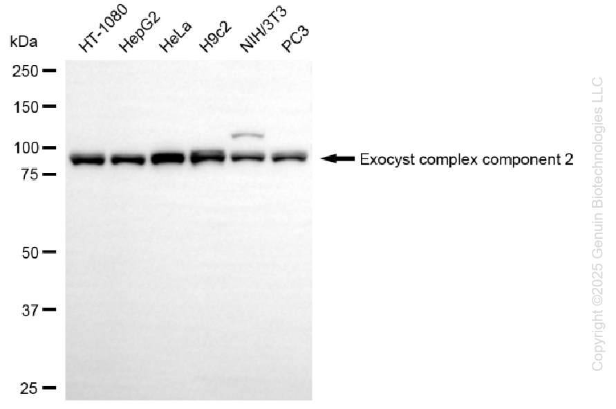 KD-Validated Anti-Exocyst Complex Component 2 Rabbit Monoclonal Antibody ABG1348