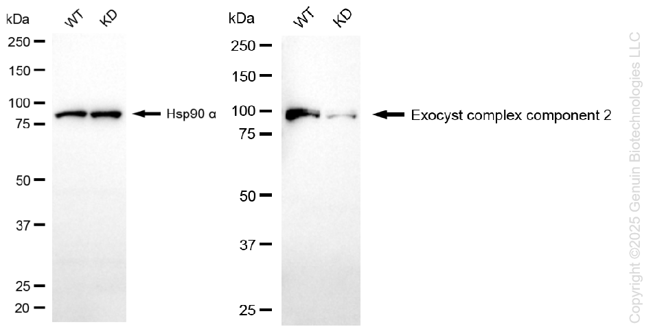 KD-Validated Anti-Exocyst Complex Component 2 Rabbit Monoclonal Antibody ABG1348