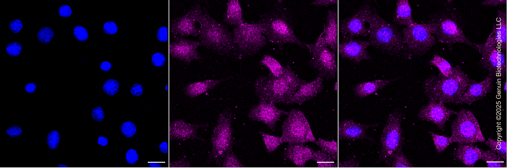 KD-Validated Anti-CAPG Rabbit Monoclonal Antibody ABG1351
