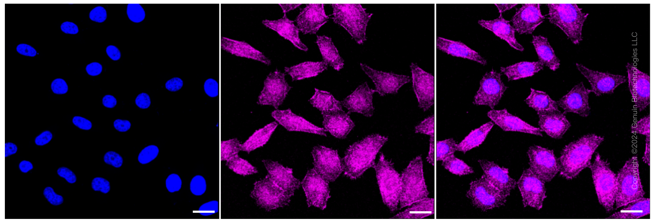 KD-Validated Anti-Phospho-beta Arrestin 1 (S412) Rabbit Monoclonal Antibody ABG1358