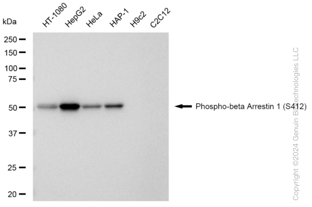 KD-Validated Anti-Phospho-beta Arrestin 1 (S412) Rabbit Monoclonal Antibody ABG1358
