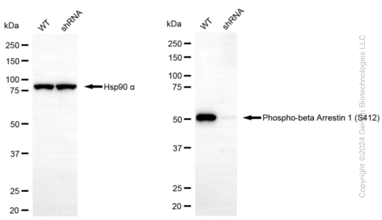 KD-Validated Anti-Phospho-beta Arrestin 1 (S412) Rabbit Monoclonal Antibody ABG1358