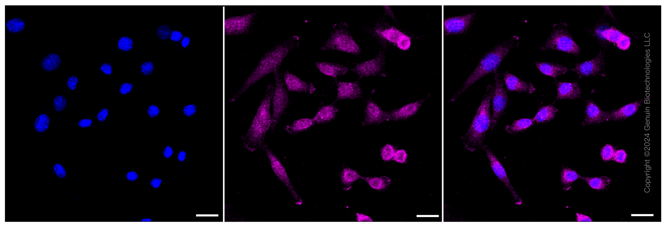 KD-Validated Anti-Rho GTPase activating protein 5 Rabbit Monoclonal Antibody ABG1361