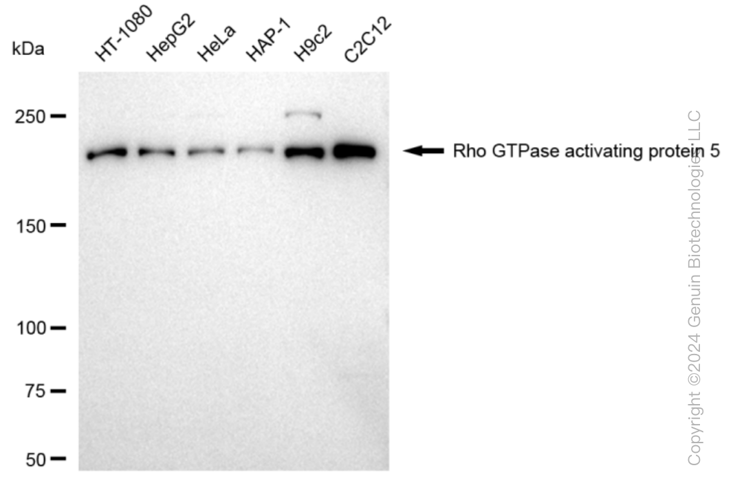 KD-Validated Anti-Rho GTPase activating protein 5 Rabbit Monoclonal Antibody ABG1361