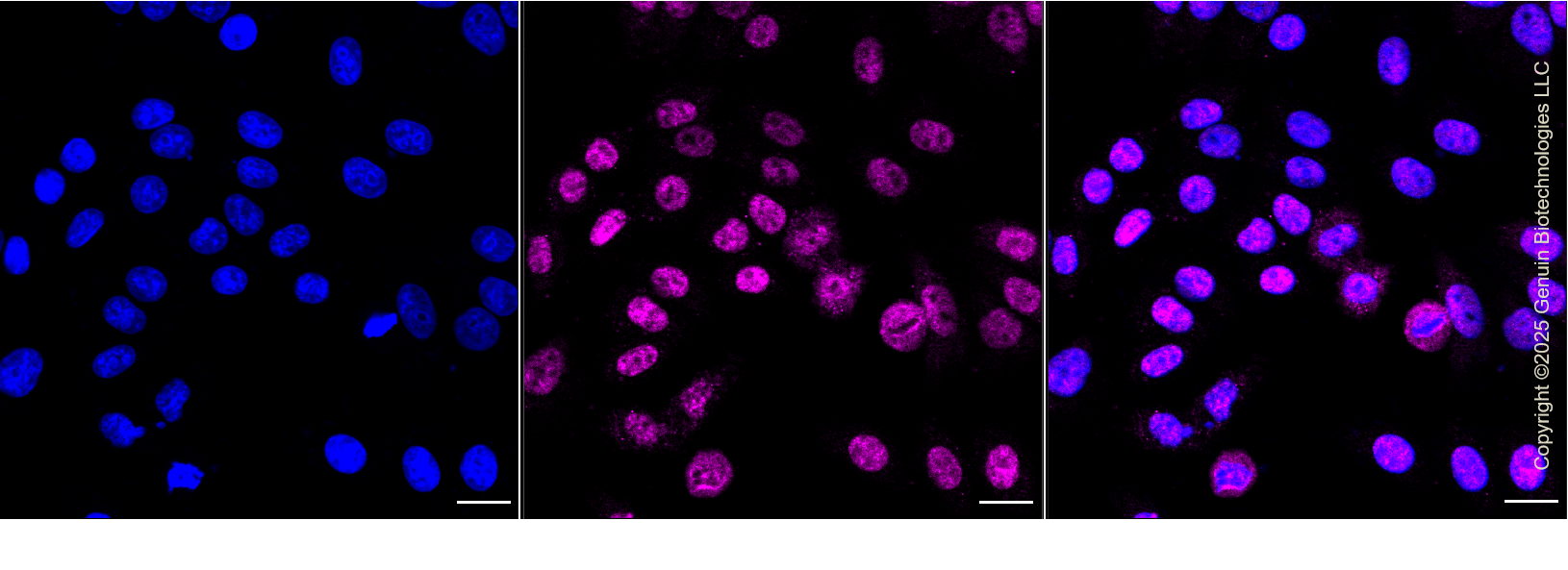 KD-Validated Anti-Adenosine Deaminase RNA Specific Rabbit Monoclonal Antibody ABG1362