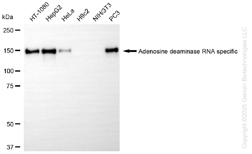 KD-Validated Anti-Adenosine Deaminase RNA Specific Rabbit Monoclonal Antibody ABG1362