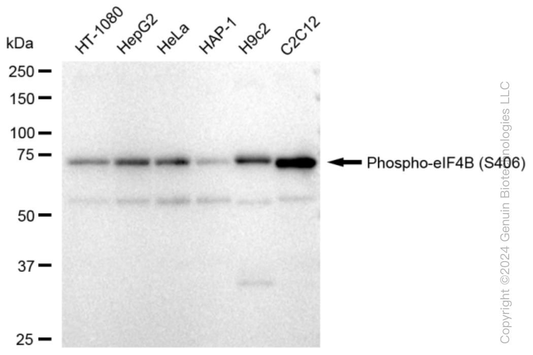 KD-Validated Anti-Phospho-eIF4B (S406) Rabbit Monoclonal Antibody ABG1366