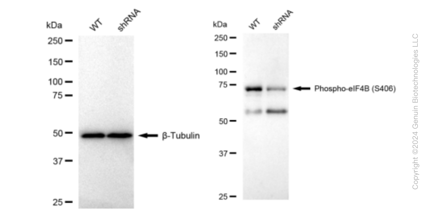 KD-Validated Anti-Phospho-eIF4B (S406) Rabbit Monoclonal Antibody ABG1366