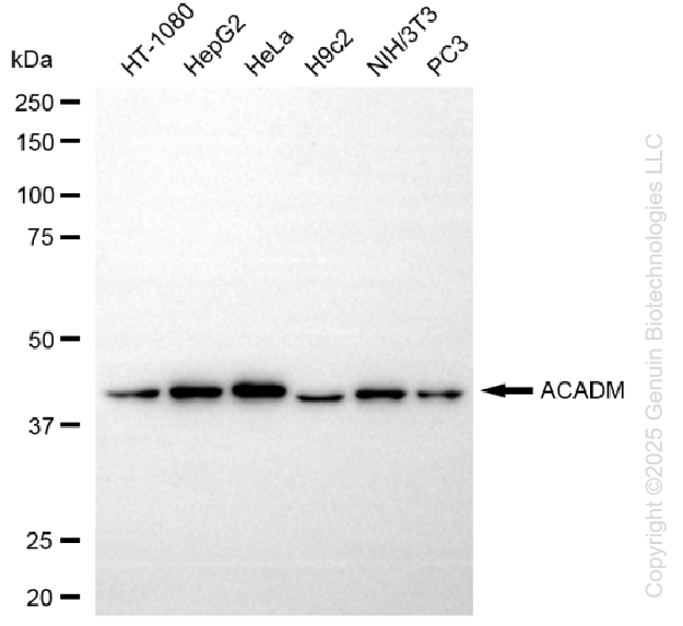 KD-Validated Anti-ACADM Rabbit Monoclonal Antibody ABG1369