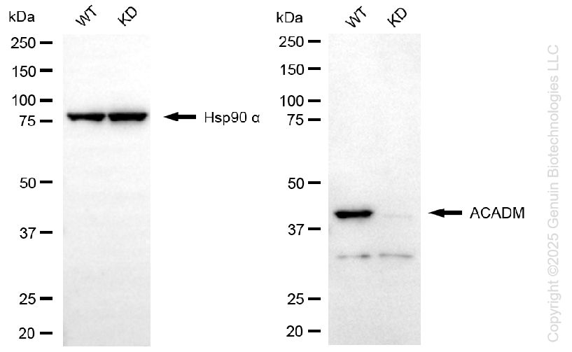 KD-Validated Anti-ACADM Rabbit Monoclonal Antibody ABG1369