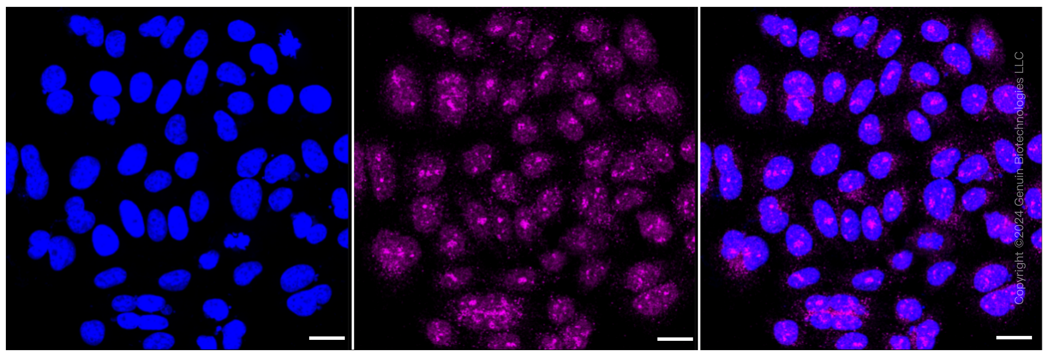 KD-Validated Anti-ATP7B Rabbit Monoclonal Antibody ABG1370