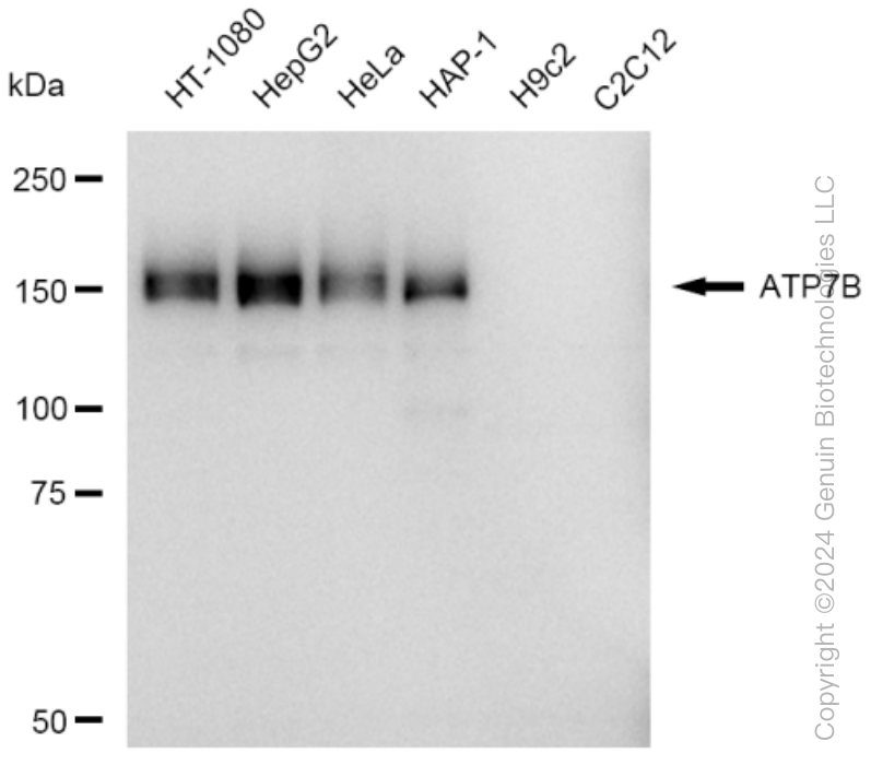 KD-Validated Anti-ATP7B Rabbit Monoclonal Antibody ABG1370