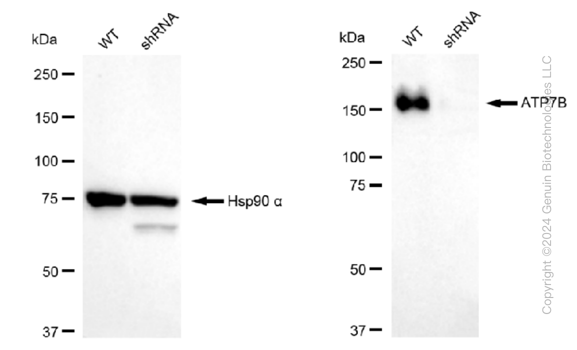 KD-Validated Anti-ATP7B Rabbit Monoclonal Antibody ABG1370