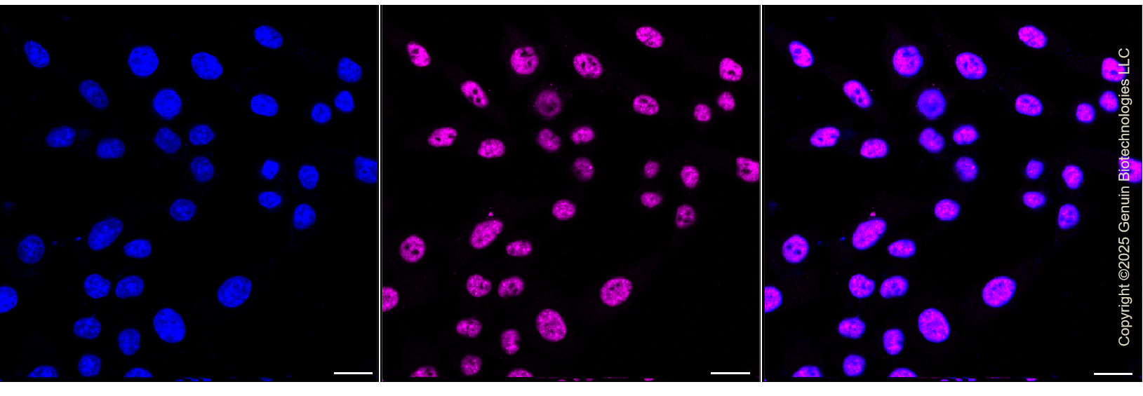 KD-Validated Anti-SNRPA1 Rabbit Monoclonal Antibody ABG1372