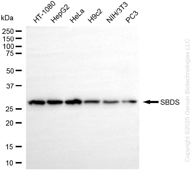 KD-Validated Anti-SBDS Ribosome MatuRation Factor Rabbit Monoclonal Antibody ABG1373