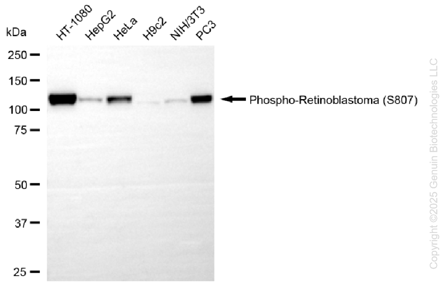 KD-Validated Anti-Phospho-Retinoblastoma (S807) Rabbit Monoclonal Antibody ABG1377