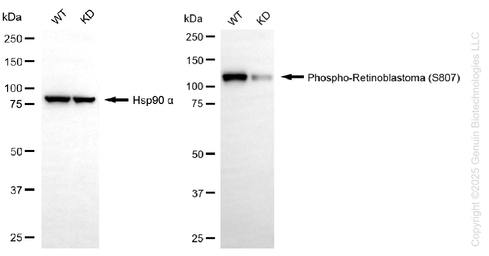 KD-Validated Anti-Phospho-Retinoblastoma (S807) Rabbit Monoclonal Antibody ABG1377