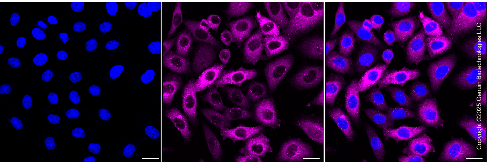 KD-Validated Anti-Sequestosome 1 Rabbit Monoclonal Antibody ABG1378